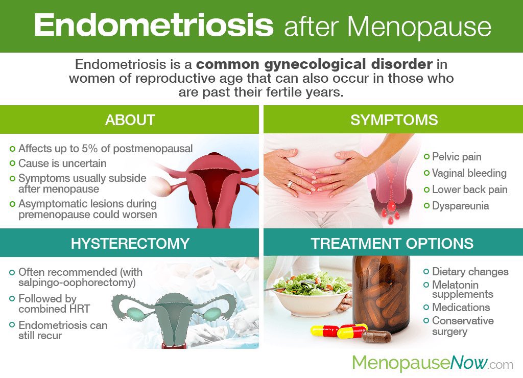 Endometriozis Tedavisi